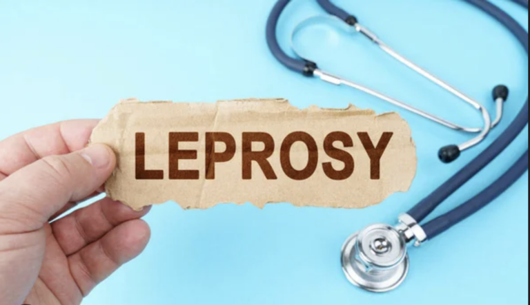 SVG increases surveillance for leprosy