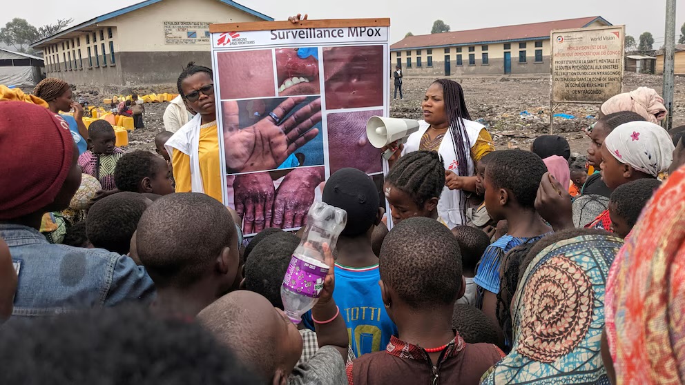 World Health Organization Declares Mpox Outbreaks in Africa as Global Emergency: Limited Vaccine Supply Raises Concern