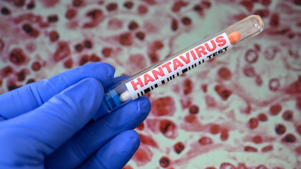 Scientist warns of possible climate link to hantavirus outbreaks