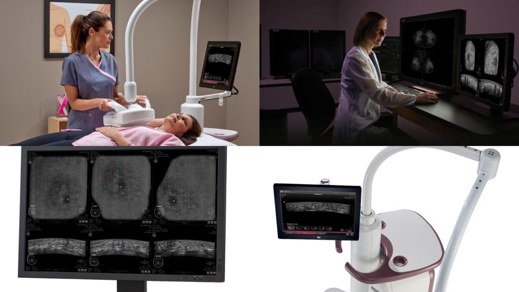 Breast ultrasound machine sought to cut wait times, improve detection